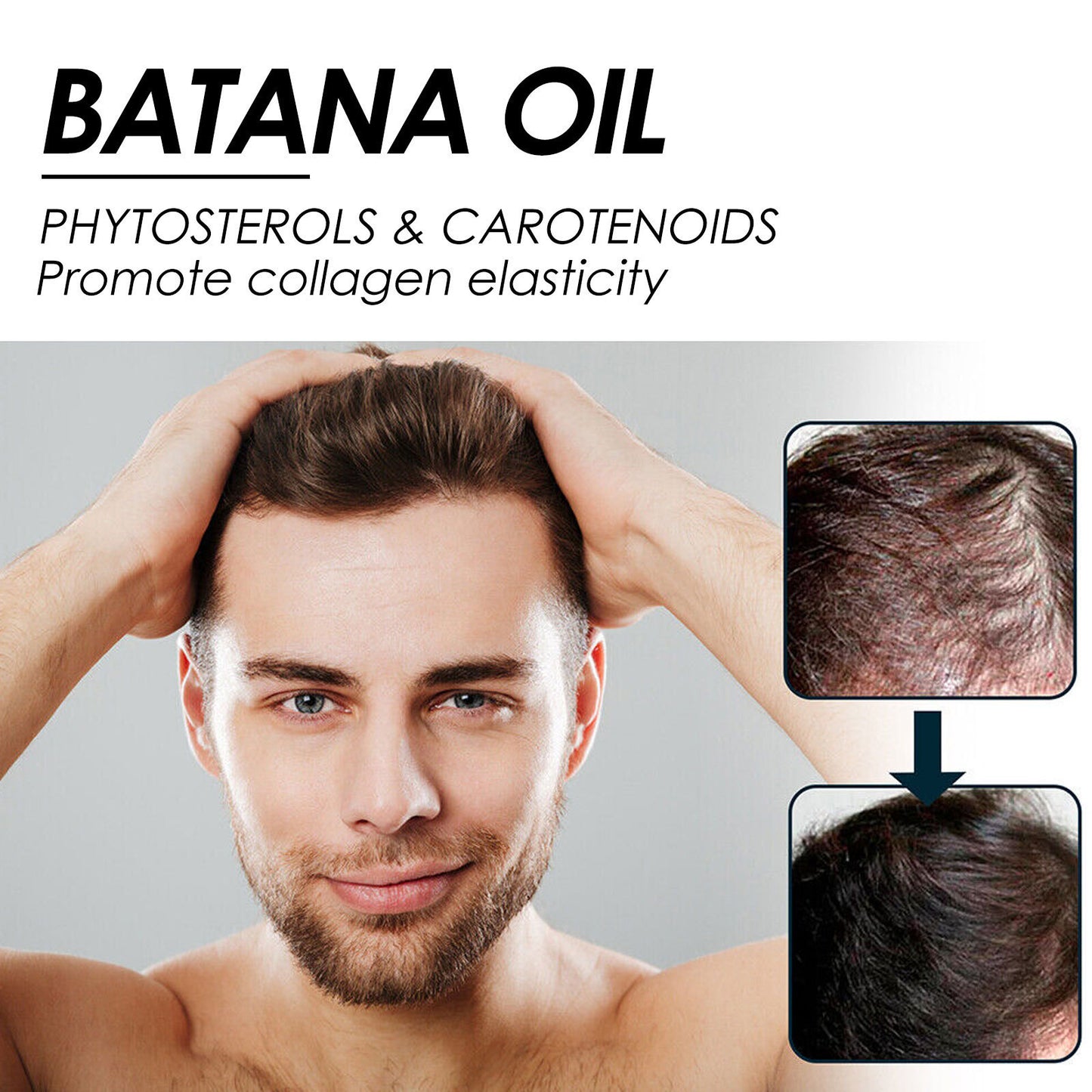 Batana Oil Hair Spray – Nourishing Scalp & Hair Care Oil for Softer, Fuller-Looking Hair