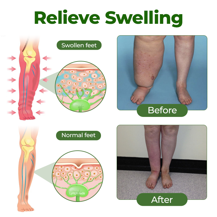 100K+ SOLD 🔥 Healrize® Professional Leg Circulation Cream