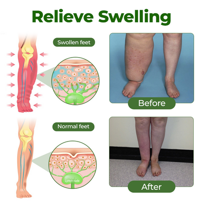 100K+ SOLD 🔥 Healrize® Professional Leg Circulation Cream
