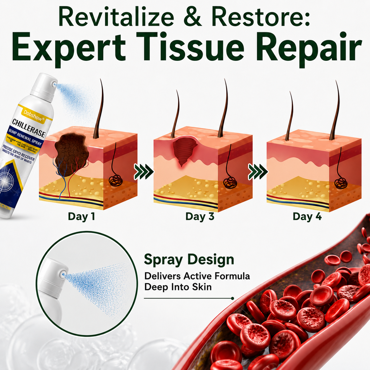 🏆 O𝐟𝐟𝐢𝐜𝐢𝐚𝐥 𝐔𝐒 𝐒𝐭𝐨𝐫𝐞   Dobshow® All-New Upgraded Skin Tag Renewal Spray