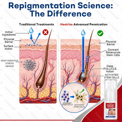 🔥100K+ SOLD Healrize® Piperine Vitiligo Repigmentation Spray - 👨‍⚕️✅Steroid-Free Botanical Formula | Gentle & Effective for All Skin Types