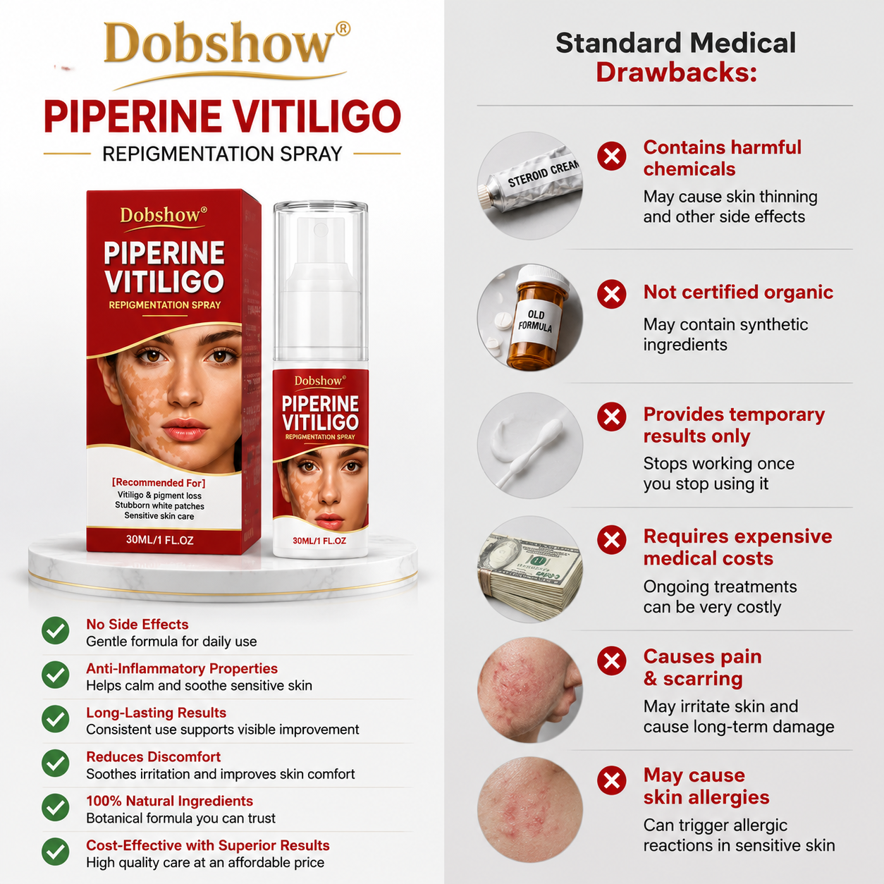 🔥100K+ SOLD | Dobshow® Advanced Piperine Vitiligo Repigmentation Spray — Upgraded Steroid-Free Botanical Formula👍