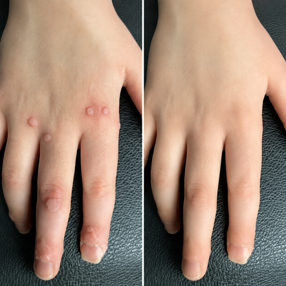 Dobshow® ✨ 2-in-1 Cryo-Cooling Bump Renewal Spray ☘️ | Targets Skin Tags, Common Warts & Rough Bumps | Helps Improve Uneven-Looking Skin | Fast-Drying Spray for Face & Body