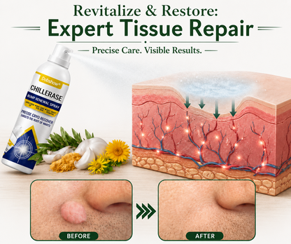 🏆 O𝐟𝐟𝐢𝐜𝐢𝐚𝐥 𝐔𝐒 𝐒𝐭𝐨𝐫𝐞   Dobshow® All-New Upgraded Skin Tag Renewal Spray