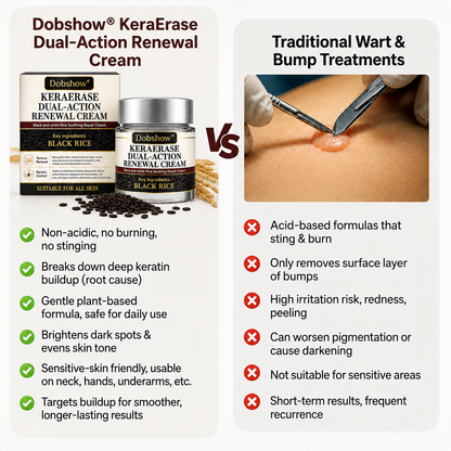 100K+ SOLD 🔥 Dobshow®  KeraErase Dual-Action Renewal Cream (New Formula)