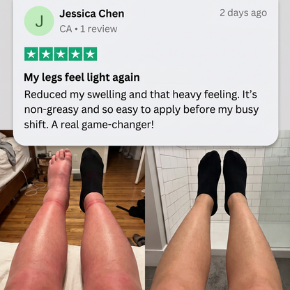 100K+ SOLD 🔥 Healrize® Professional Leg Circulation Cream