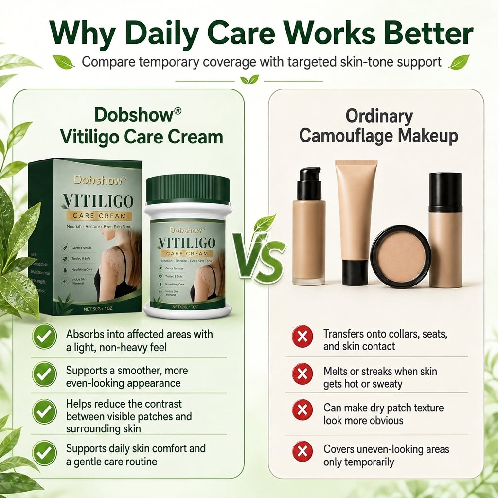 100K+ SOLD 🔥 Dobshow® Herbal Vitiligo Cream 👍