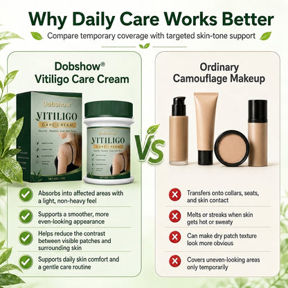 100K+ SOLD 🔥 Dobshow® Herbal Vitiligo Cream 👍