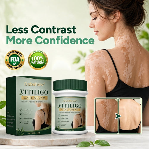 100K+ SOLD 🔥 Dobshow® Herbal Vitiligo Cream 👍
