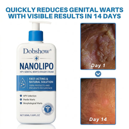 100K+ SOLD 🔥 Dobshow®    NanoLipo H-P-V Intimate Renewal Cream