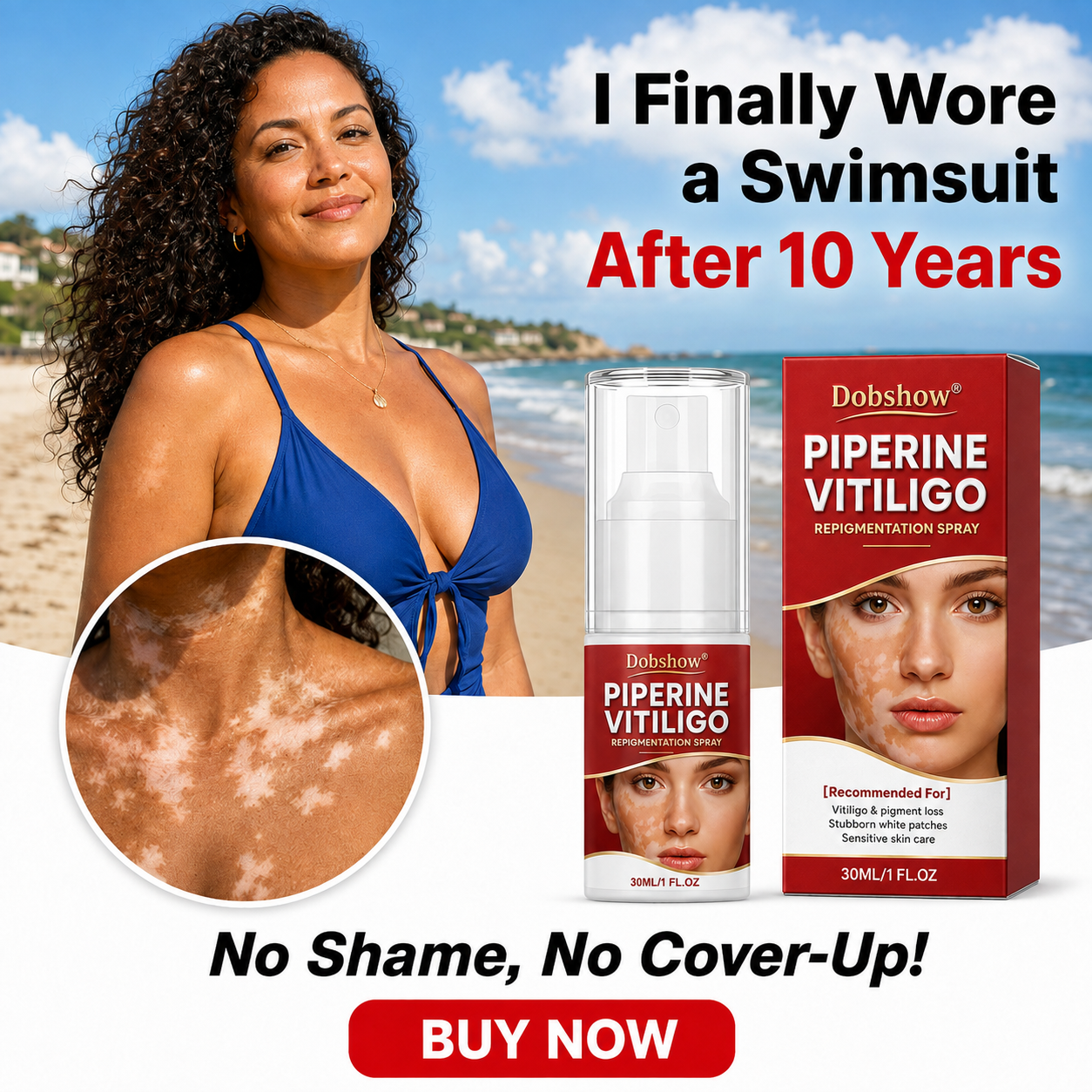 🔥100K+ SOLD | Dobshow® Advanced Piperine Vitiligo Repigmentation Spray — Upgraded Steroid-Free Botanical Formula👍