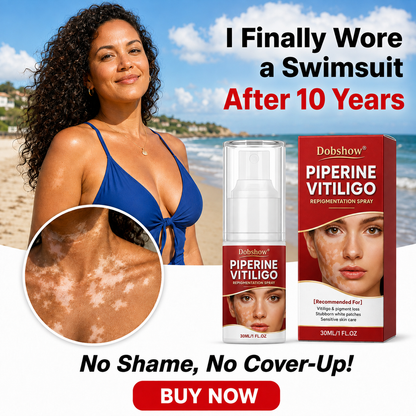 🔥100K+ SOLD | Dobshow® Advanced Piperine Vitiligo Repigmentation Spray — Upgraded Steroid-Free Botanical Formula👍