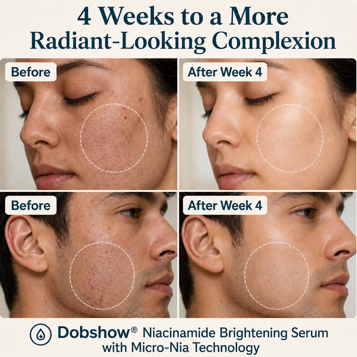 Dobshow® Micro-Nia™ Encapsulated Niacinamide Brightening Serum in 4 weeks