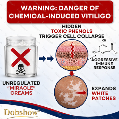 🔥100K+ SOLD | Dobshow® Advanced Piperine Vitiligo Repigmentation Spray — Upgraded Steroid-Free Botanical Formula👍