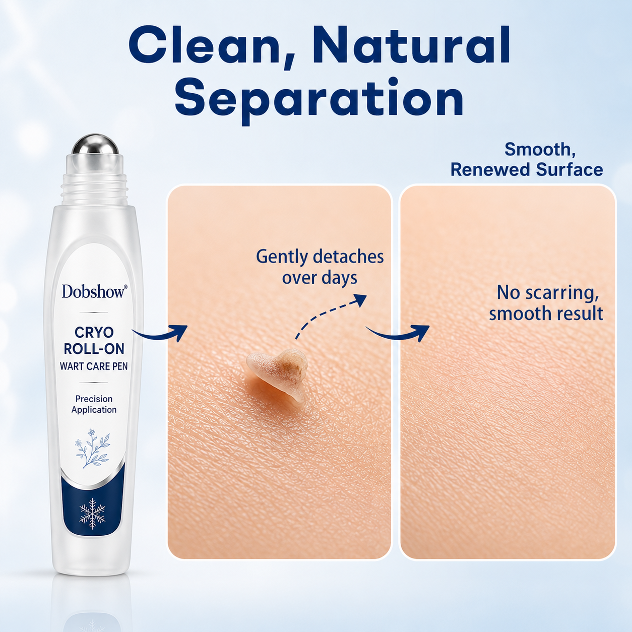 🏆𝐎𝐟𝐟𝐢𝐜𝐢𝐚𝐥 𝐔𝐒 𝐒𝐭𝐨𝐫𝐞 | 100K+ Sold🔥| 100K + Sold  | Dobshow® 7 -Day Wart & Blemish Remover